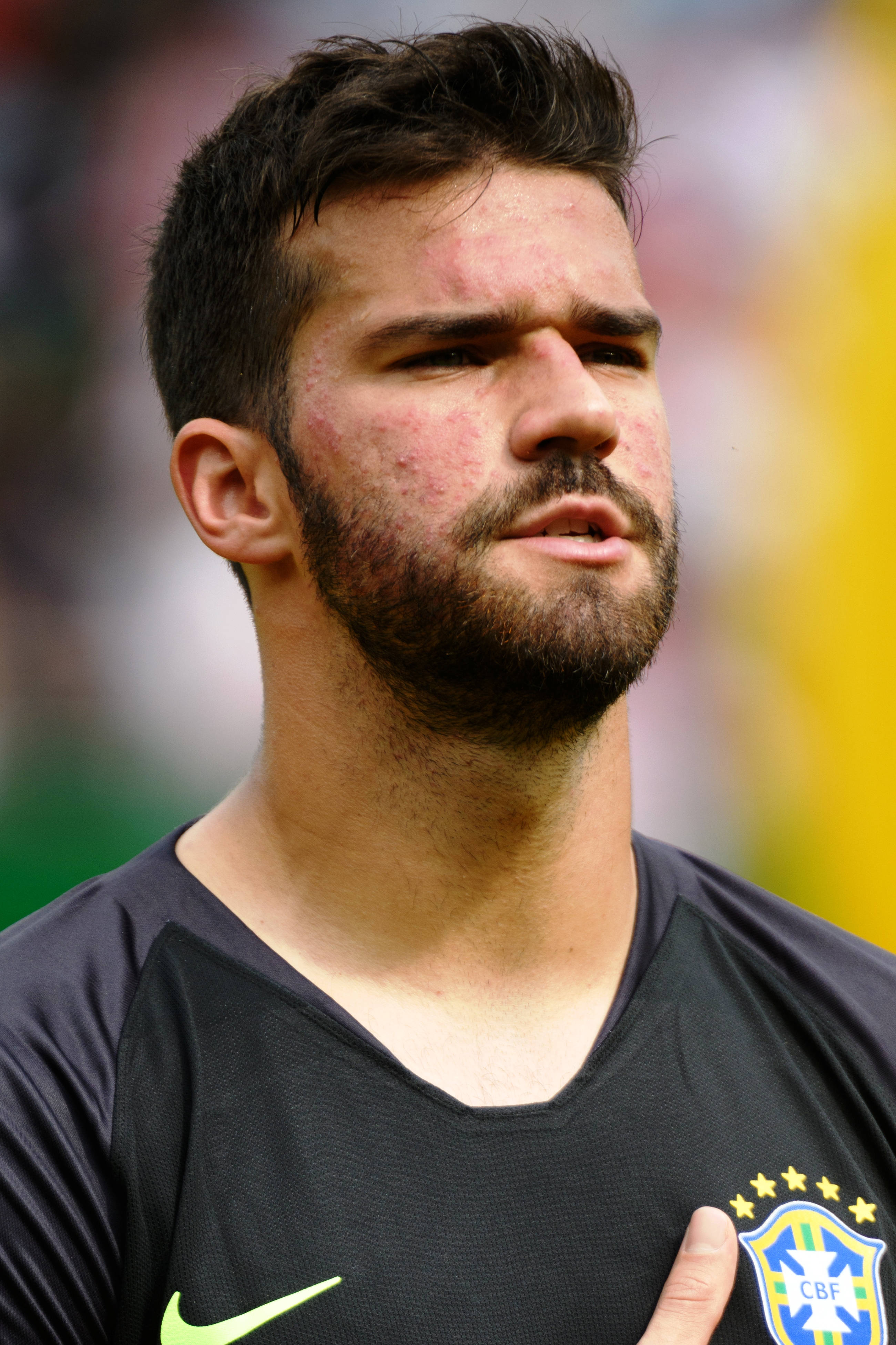 Alisson Becker Yakın Plan Profil Duvar Kağıdı